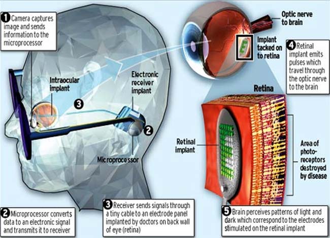 Bionic Eye Working