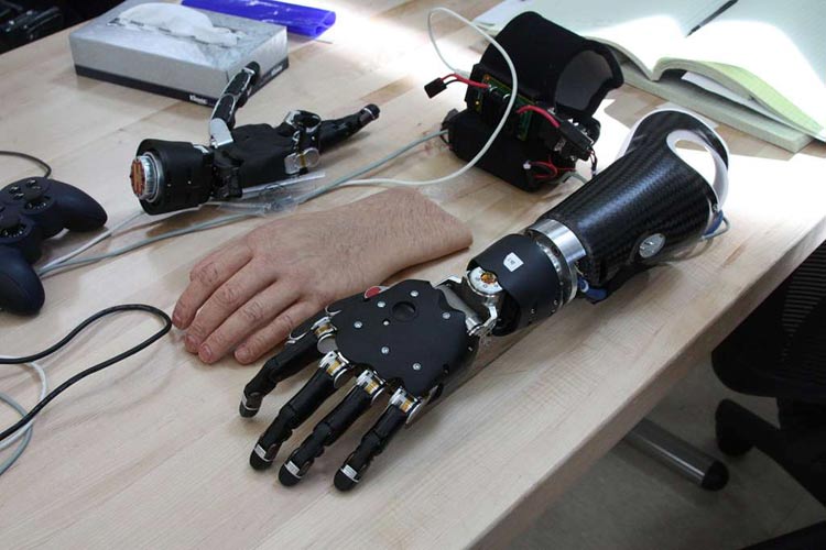 Bionic Arm