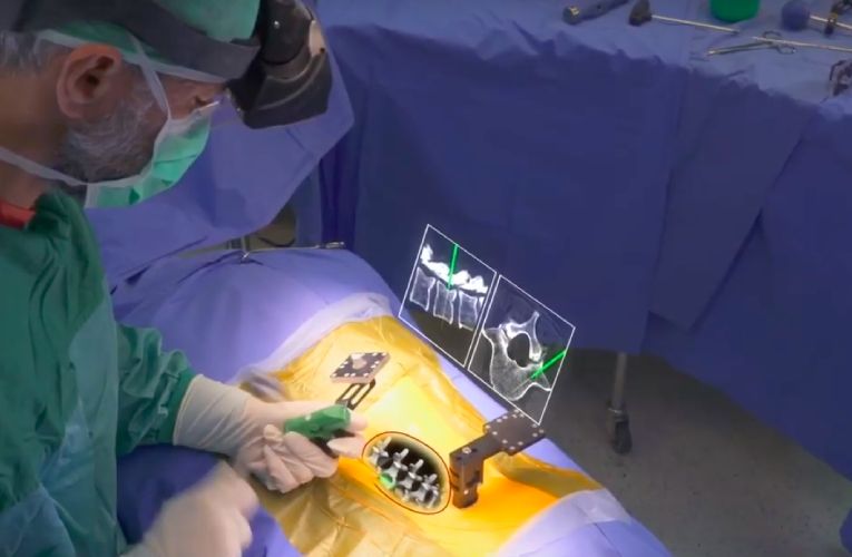 Xvision Spine – FDA Approved Augmented Reality Surgical Guidance System