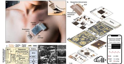 Wearable Ultrasound System