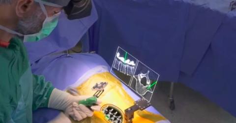 Xvision Spine – FDA Approved Augmented Reality Surgical Guidance System